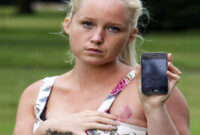iphone-4-membakar-dada-ibu-muda-ini Dionne Baxter. © Dailymail.co.uk
